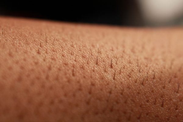 When turning on the hairdryer, one must first measure the temperature and the distance from the skin. (Image: tarkan36, Pixabay, CC0)