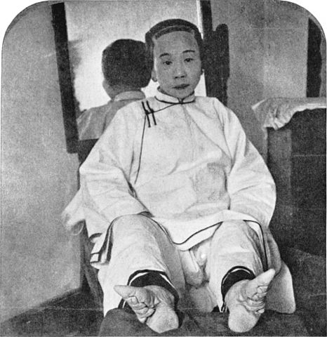 foot binding