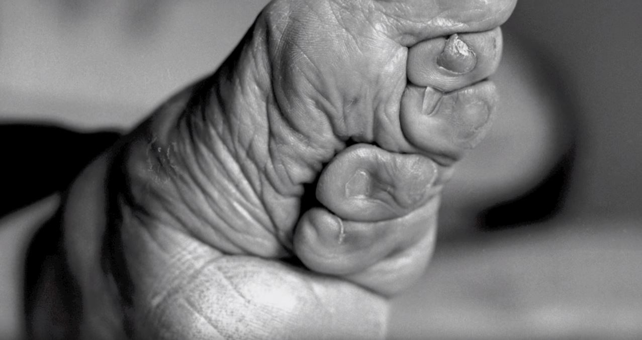 Those who had their feet bound to become more desirable, now found themselves being abandoned by their husbands as it was no longer fashionable. (Image: YouTube/Screenshot via Living History: Bound Feet Women of China)