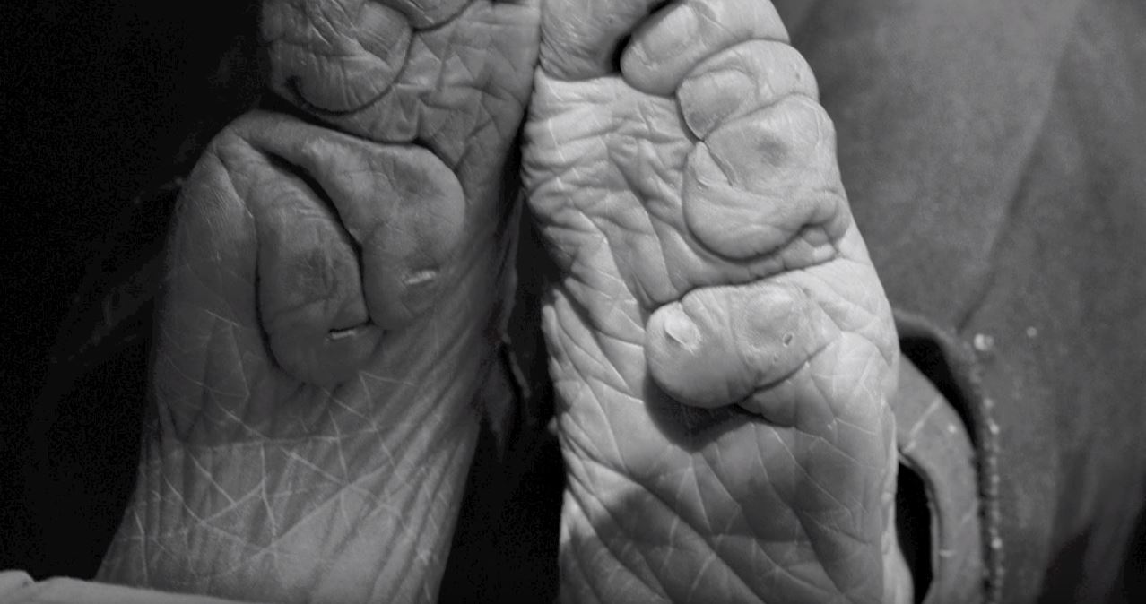 For these women, the process that began with a lot of pain and tears would likewise have ended with pain and tears. (Image: YouTube/Screenshot via Living History: Bound Feet Women of China)