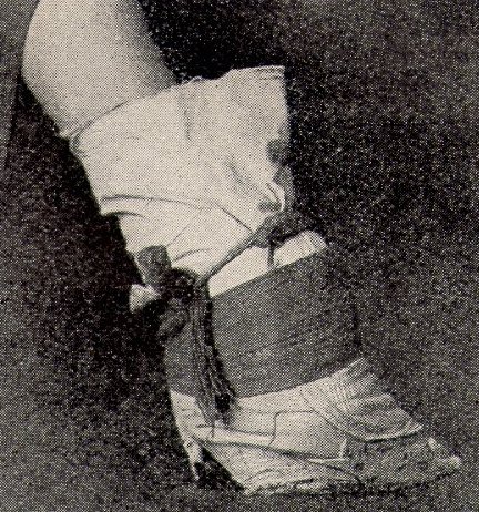 foot binding