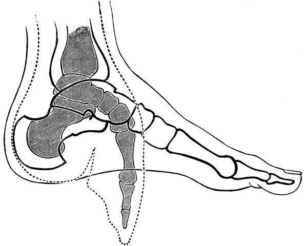 foot binding