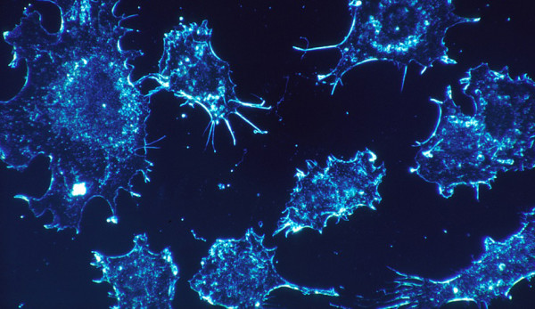 The tumors themselves are usually heterogeneous – meaning that different parts of the tumor contain different genetic mutations – which means treatments focused on only one target are ineffective or only partially effective. (Image via pixabay / CC0 1.0)