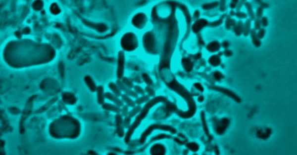 E.coli L-form switching - so from walled to without a wall. (Image: Newcastle University)