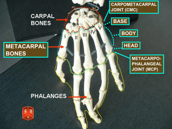 A left hand with the metacarpal bones noted. (Image: Anatomist90 via wikimedia CC BY-SA 3.0)