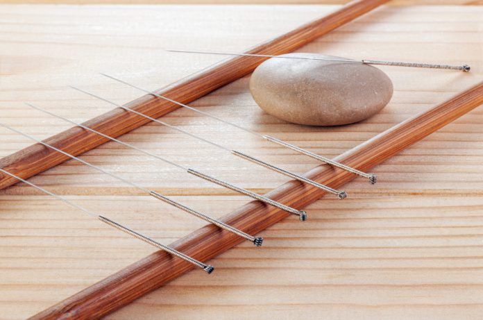 Silver needles for traditional Chinese acupuncture medicine on a wooden table.