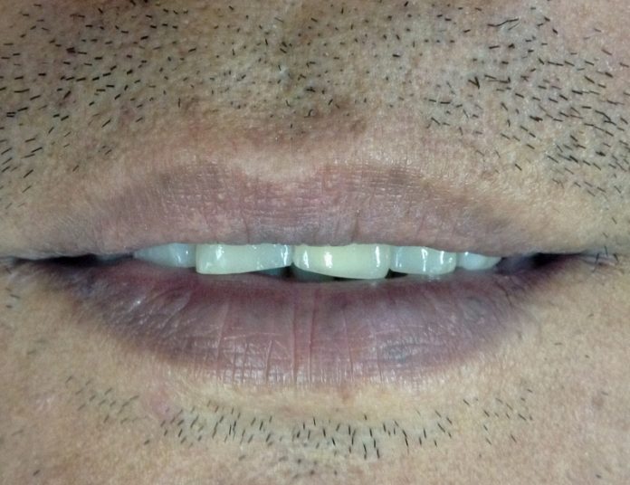 Your natural lip color can indicate health issues.