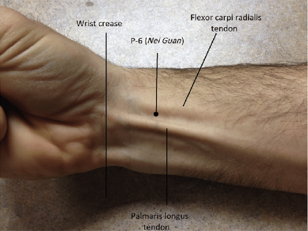 The Neiguan point (Inner Frontier Gate), also known as the Pericardium (P-6) point, is quite a celebrity in the acupuncture practice of TCM.