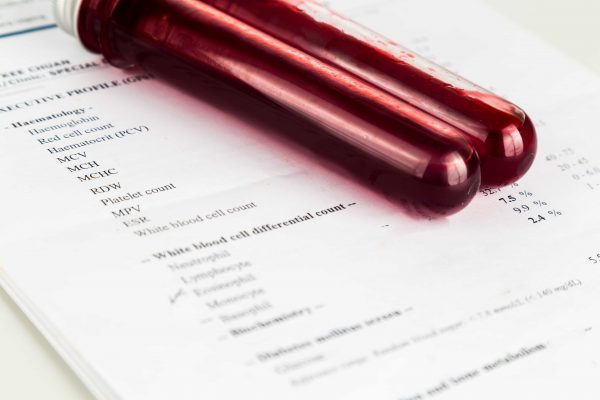 HIV_blood_test