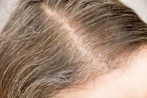 Woman beginning to get premature gray hair.