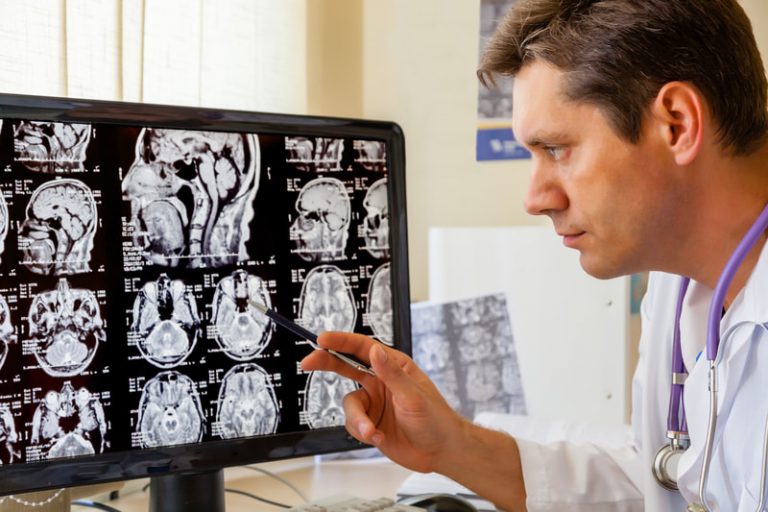 A doctor examines an MRI scan.