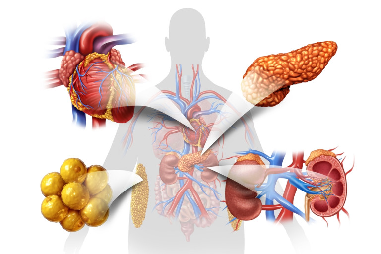 Graphic showing ardiovascular kidney metabolic syndrome as a multisystem disorder as a disease related to a group of organs including kidneys, heart, pancreas, and adipose cells with 3D illustration elements.