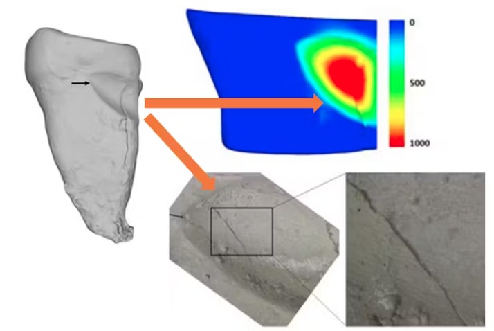 3D map of tissue loss within a root groove (scale in microns) and microwear features in the same groove, showing parallel fine scratches, in an orangutan.