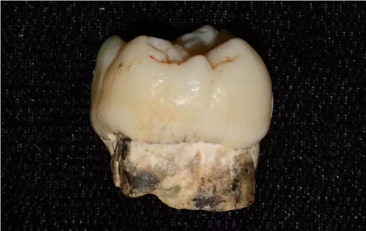 Our ancestors were exposed to lead for millions of years, and it may have helped shape the evolution of the human brain.