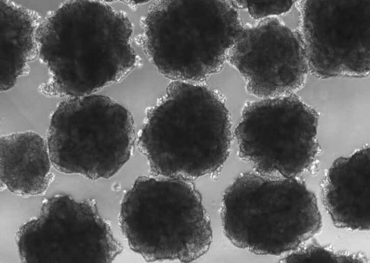 Brain organoids akin to Neanderthal genes.