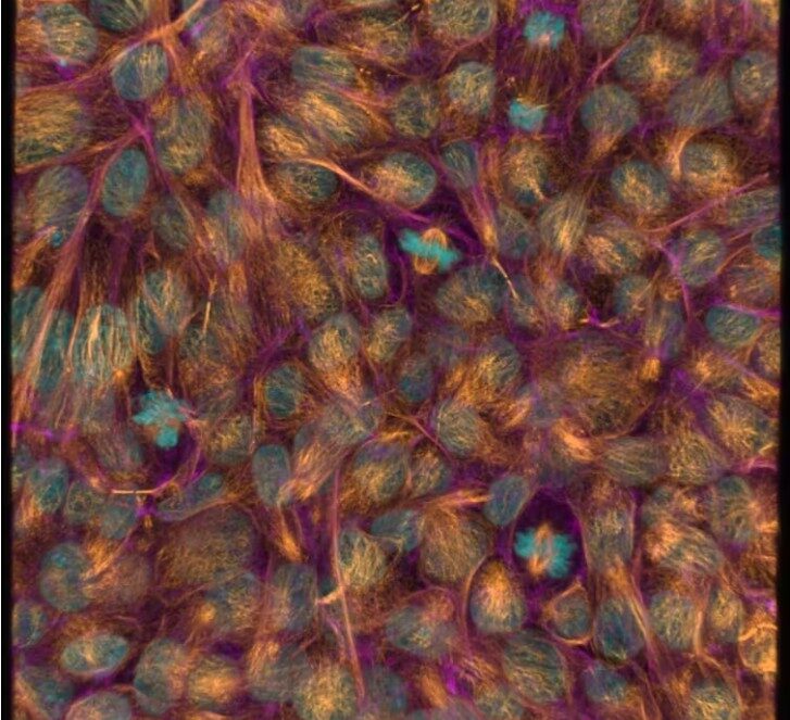 A blastocyst embryo where the inner cell mass can be seen. These are typically isolated to culture embryonic stem cells.