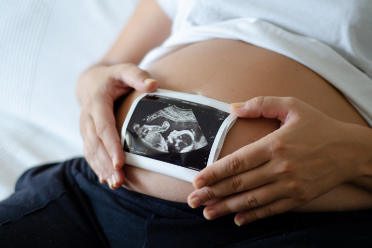 Woman holding an image from a sonogram over her pregnant belly.