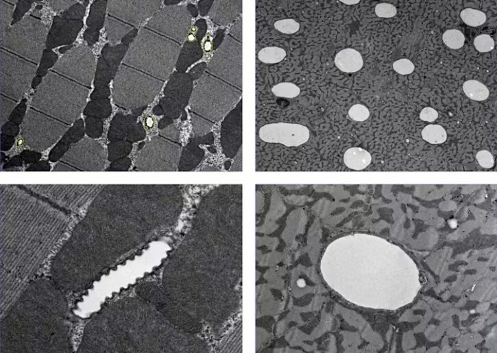 Under the electron microscope, thin slices of insect muscle (left) and mammal muscle (right) show the tracheoles and capillaries in white.