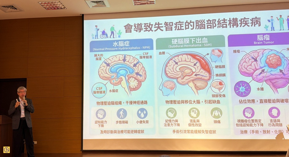 Dr. Sung Sheng-feng pointed out some structural brain diseases that lead to dementia.