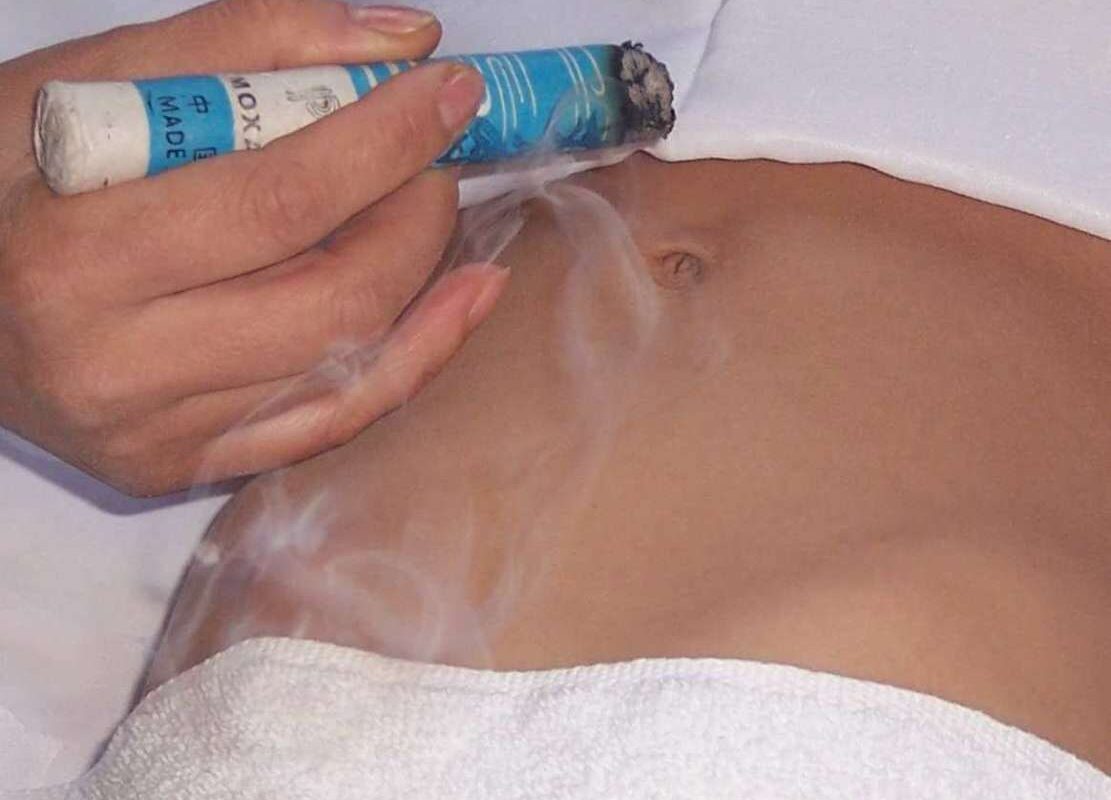 The gentler and more common method is indirect moxibustion. Here, the practitioner lights a moxa stick and holds it a short distance above the navel, close enough for the patient to feel a comfortable, glowing warmth, but without direct contact with the skin.
