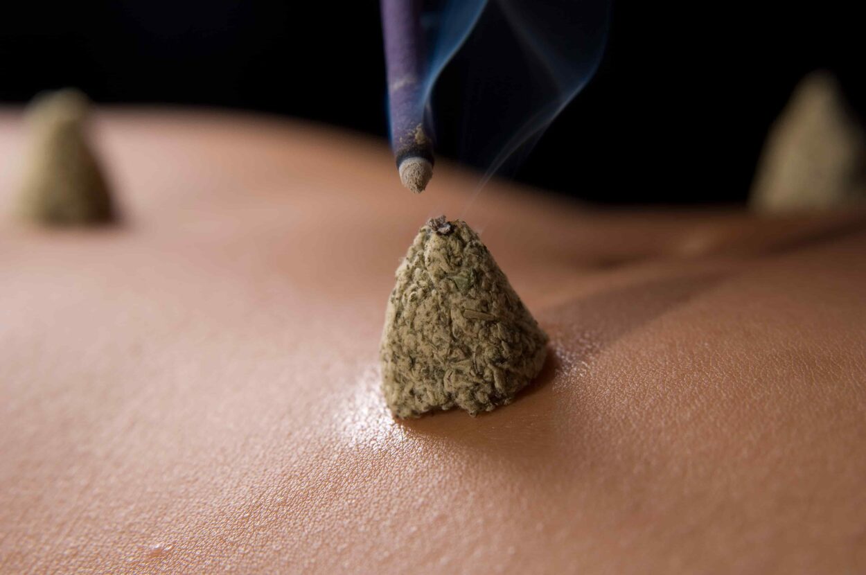 For most of its history, navel moxibustion rested on tradition and lived experience. In recent years, researchers have begun studying it, and the early picture is intriguing, if still incomplete.