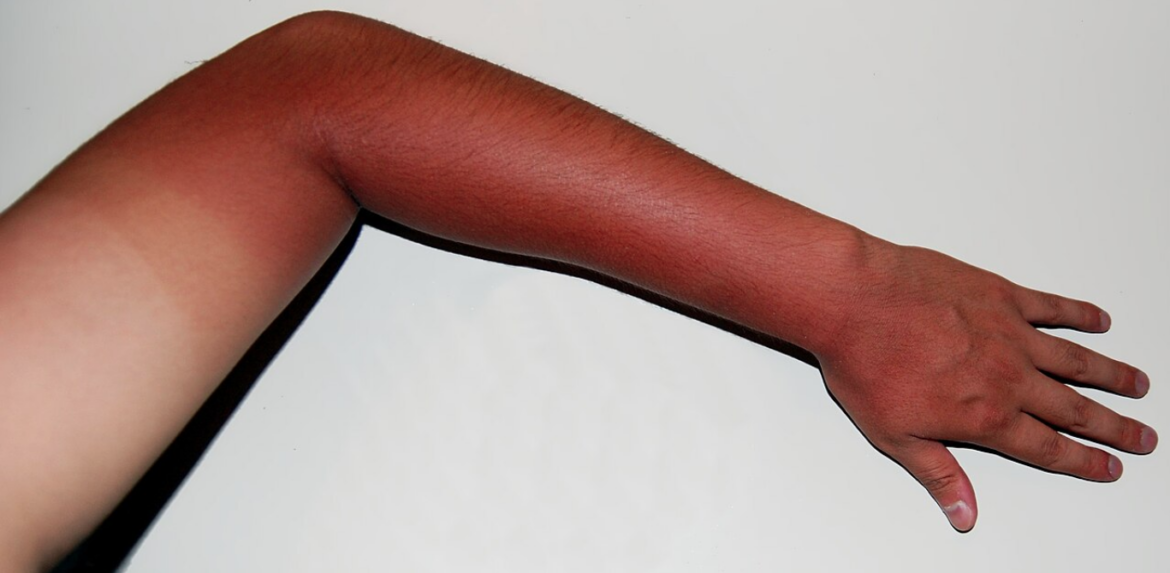 A tanned arm.